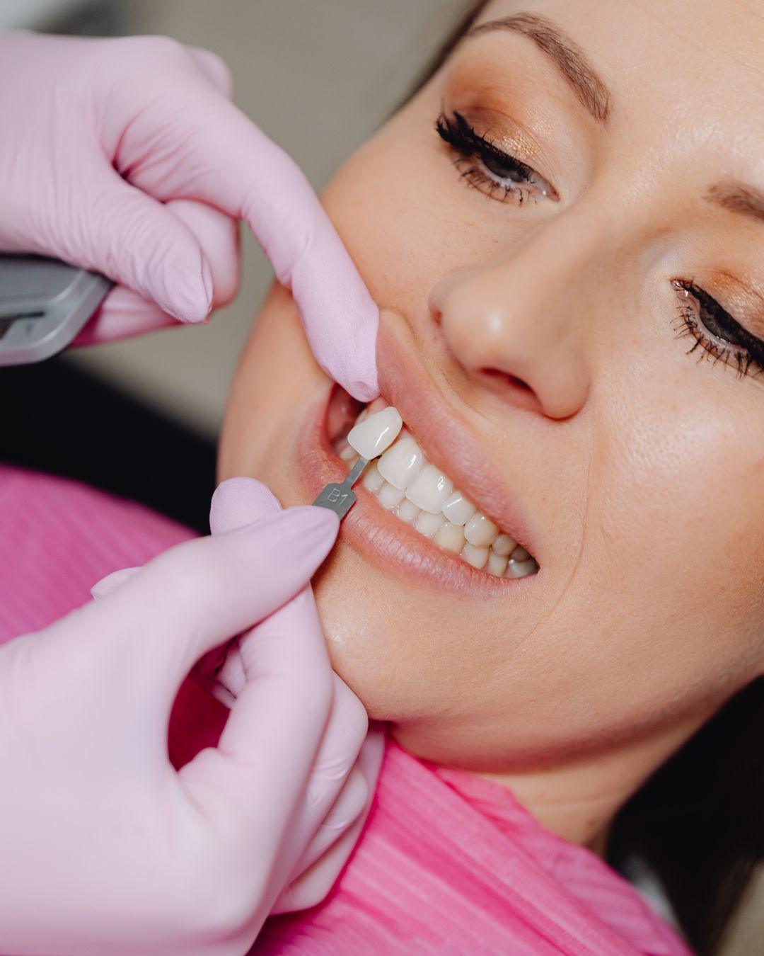 Rehabilitación Oral